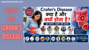 Crohn’s Disease Kya Hai Aur Kyu Hota? जानिए क्रोहन रोग के कारण, लक्षण, इलाज और लंबे समय तक नियंत्रण के उपाय
