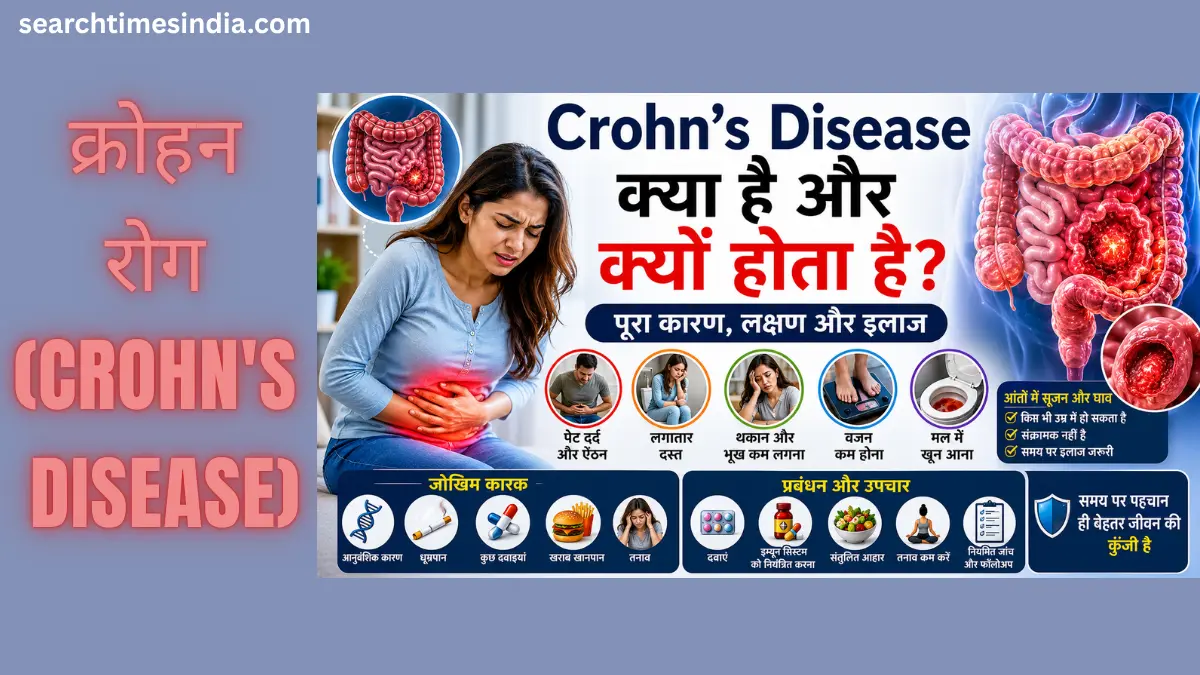 Crohn's Disease Kya Hai Aur Kyu Hota? जानिए क्रोहन रोग के कारण, लक्षण, इलाज और लंबे समय तक नियंत्रण के उपाय