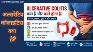 Ulcerative Colitis Kya Hai Aur Kyu Hota Hai? जानिए इसके कारण, लक्षण, इलाज और लंबे समय तक नियंत्रण के उपाय