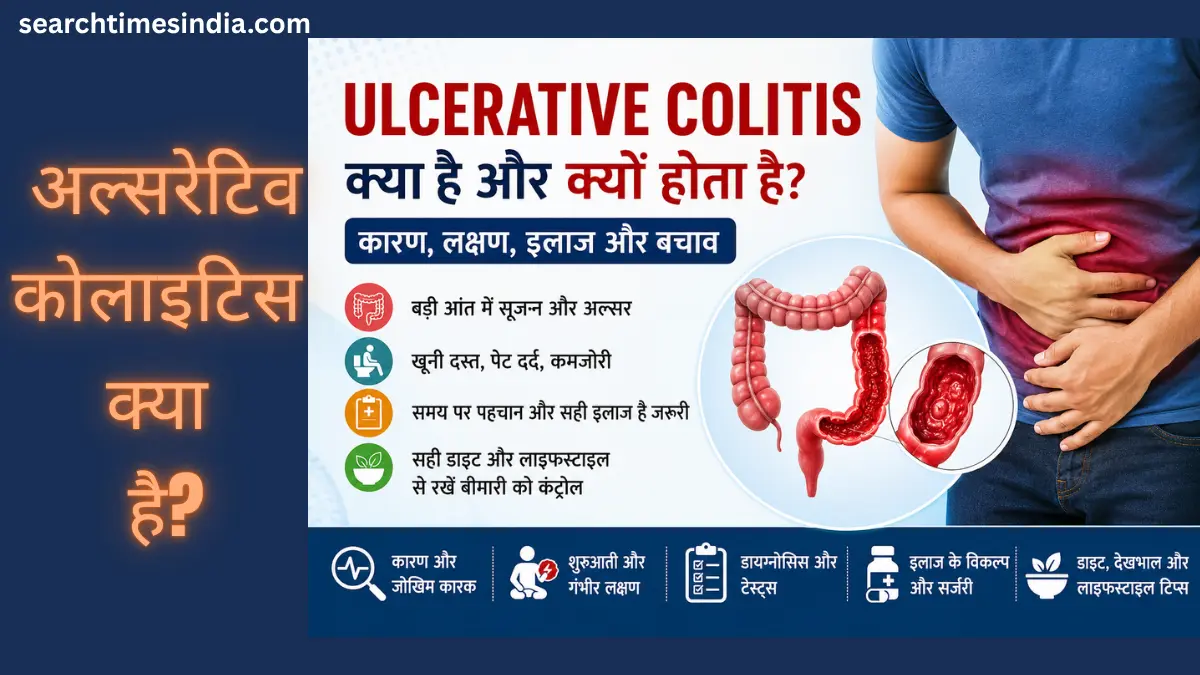 Ulcerative Colitis Kya Hai Aur Kyu Hota Hai? जानिए इसके कारण, लक्षण, इलाज और लंबे समय तक नियंत्रण के उपाय